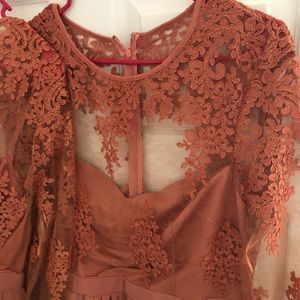 A beautiful lace dress